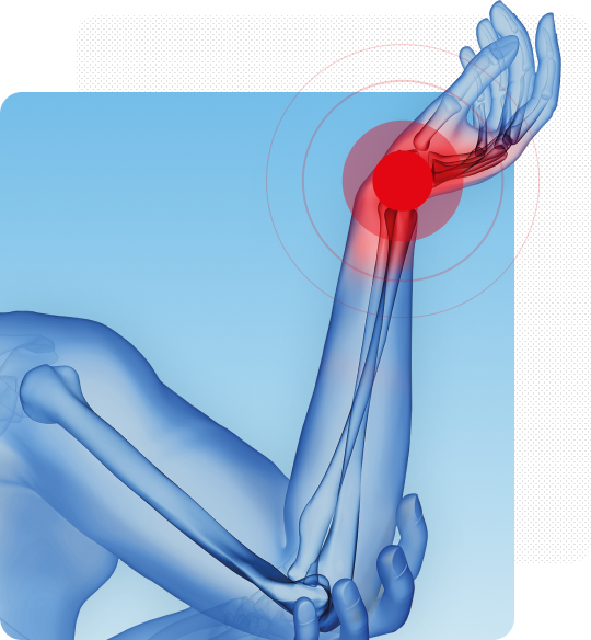 Как развивается воспаление?
